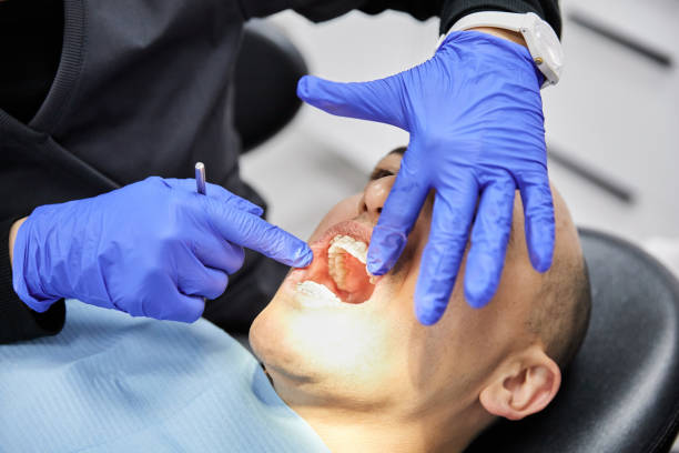 Best Emergency Dental Care for Sports Injuries in Saginaw, MI
